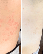 Sensitive Skincare Bundle